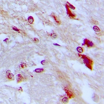 C/EBP epsilon (pT74) Antibody