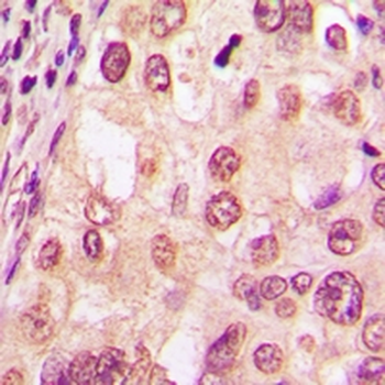 Glucocorticoid Receptor (pS226) Antibody