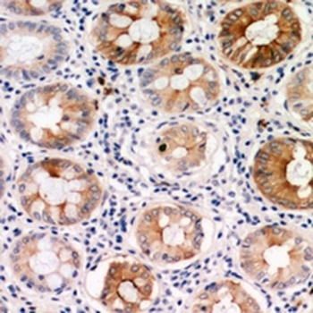 PDGFC Antibody