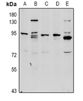 Complement C1R HC Antibody
