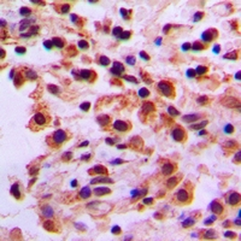 ARHGEF19 Antibody