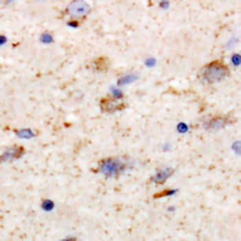 KCNT1 Antibody