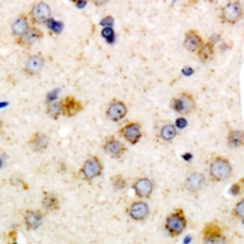 CHSY1 Antibody