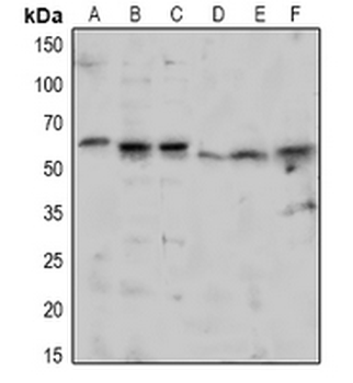 TAB1 (pS438) Antibody