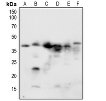 NACA1 (pS43) Antibody