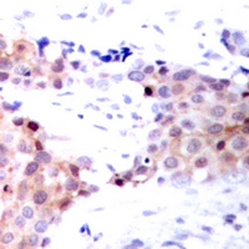 NACA1 (pS43) Antibody