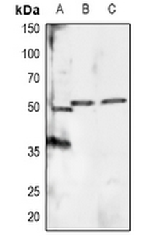 RXR alpha (pS260) Antibody
