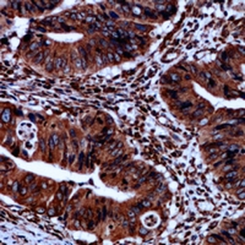 iNOS (pY151) Antibody
