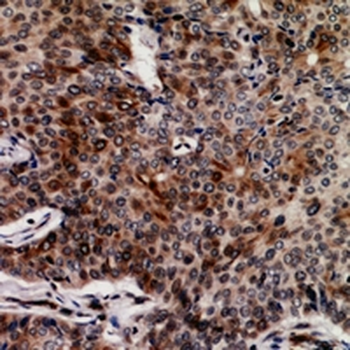 FASTKD3 Antibody