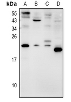 AVP Antibody