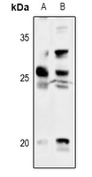 Thymidine Kinase 1 Antibody