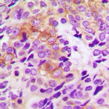 Thymidine Kinase 1 Antibody