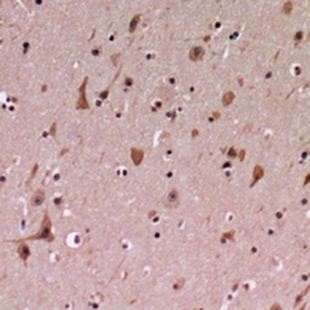 PDCD12 Antibody