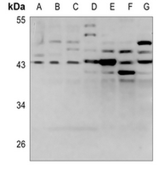 LPAAT gamma Antibody