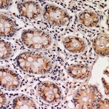 EPS8L1 Antibody