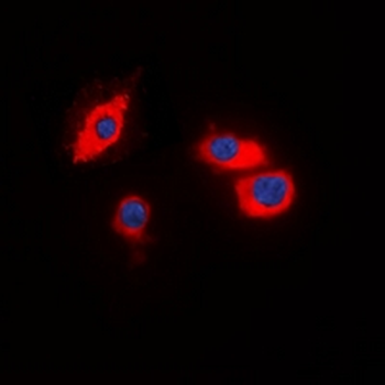 CIDEB Antibody
