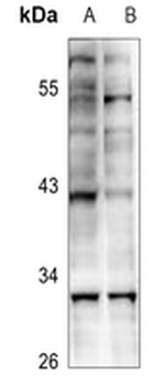 KLF13 (AcK166) Antibody