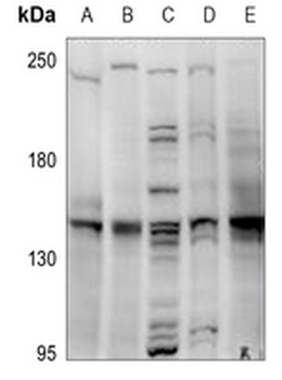 MYBPC3 Antibody