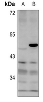 MKI67IP (pT234) Antibody