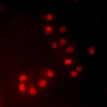 MKI67IP (pT234) Antibody