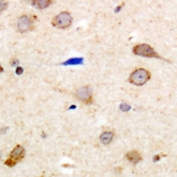 EDG5 Antibody