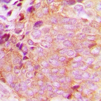 CaMKK beta Antibody