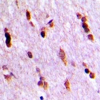 Ubiquilin 4 Antibody