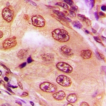 SPAK Antibody