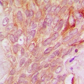 QSK Antibody