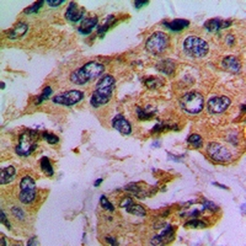 Prosaposin Antibody
