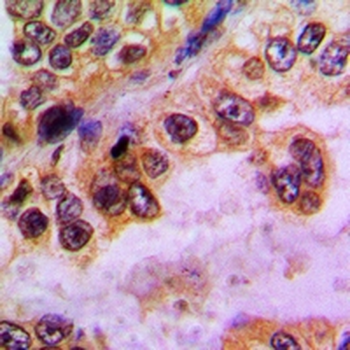 GABRD Antibody
