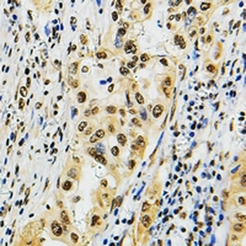 POLR3B Antibody