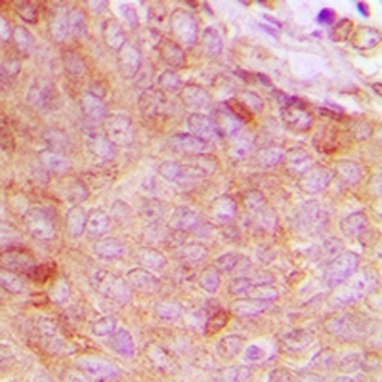 Copine 8 Antibody
