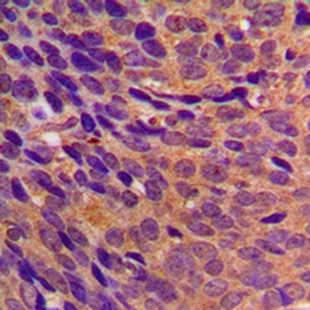 CBR3 Antibody