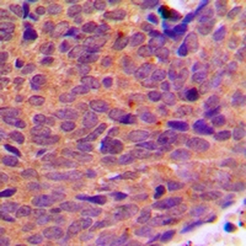 DDX19B Antibody