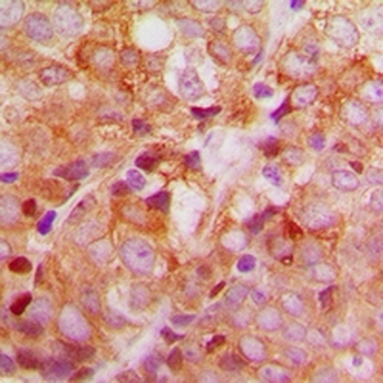 ACBD6 Antibody