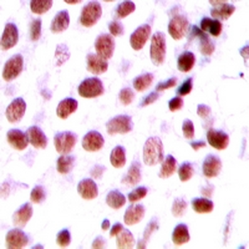 DIDO1 Antibody