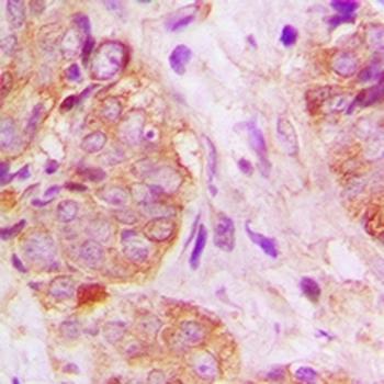 GSPT1 Antibody