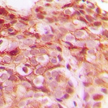 DNAJB4 Antibody