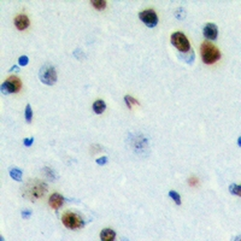 ZC3H7B Antibody