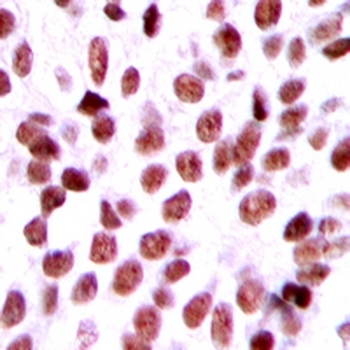 BCA3 Antibody