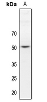 Dematin Antibody