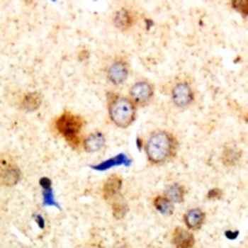 Dematin Antibody