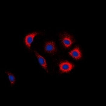 EGFR (pY1016) Antibody
