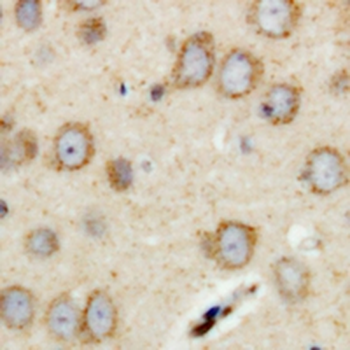 RIMS4 Antibody