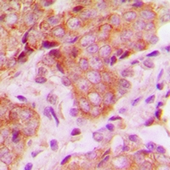 MRPS22 Antibody