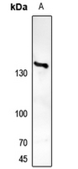 TRK A Antibody