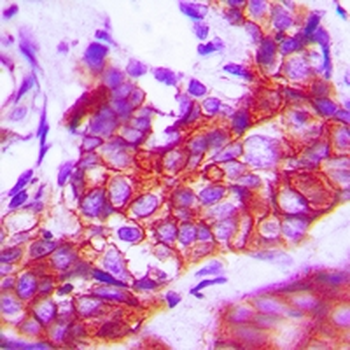 TRK A Antibody