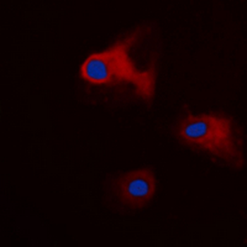 14-3-3 theta/tau (pS232) Antibody