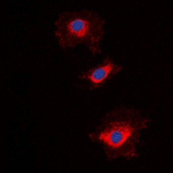 NT5C1A Antibody